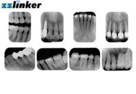 17 nivel gris del pedazo intraoral dental del escáner 14 de la resolución de Lp/Mm tamaño pequeño