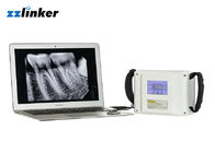 20KHz médico oral LCD 7800mAh 80W X dental Ray Unit